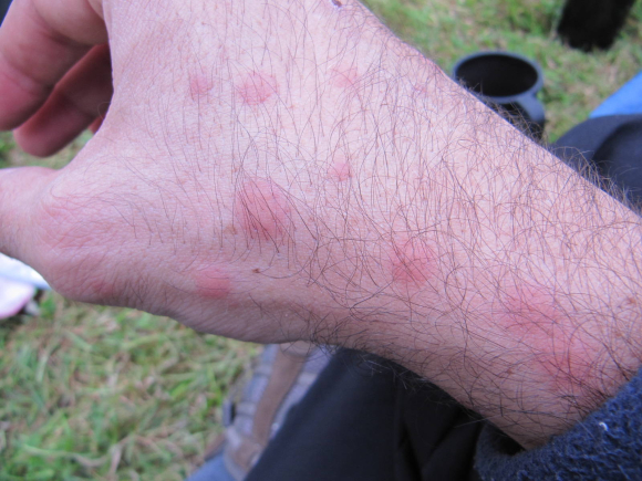 Bouffé de partout par les midges...